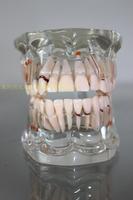 牙科材料 病理模型 透明性成人综合模型 齿科 口腔模型 包邮